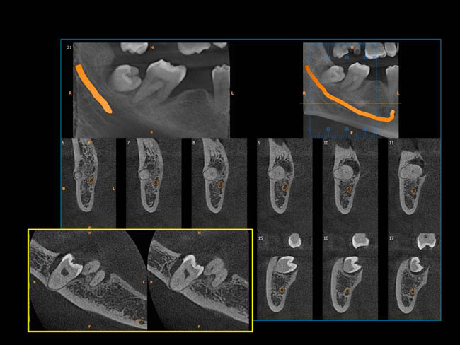 Oromax Imaging radiology & oral